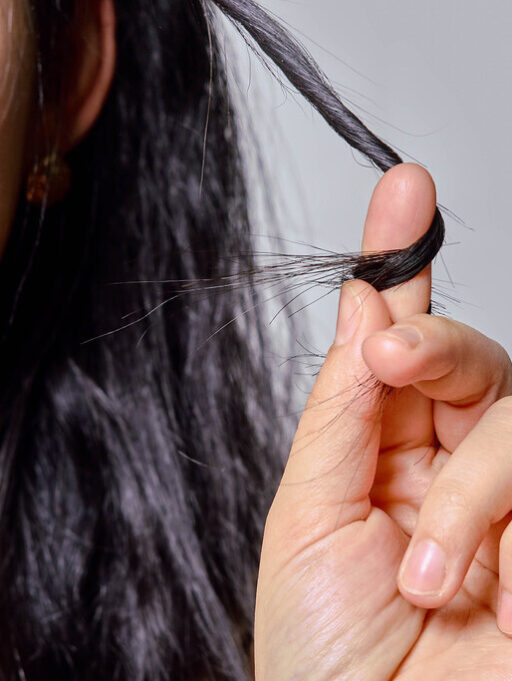 Chute de cheveux: Les véritables raisons